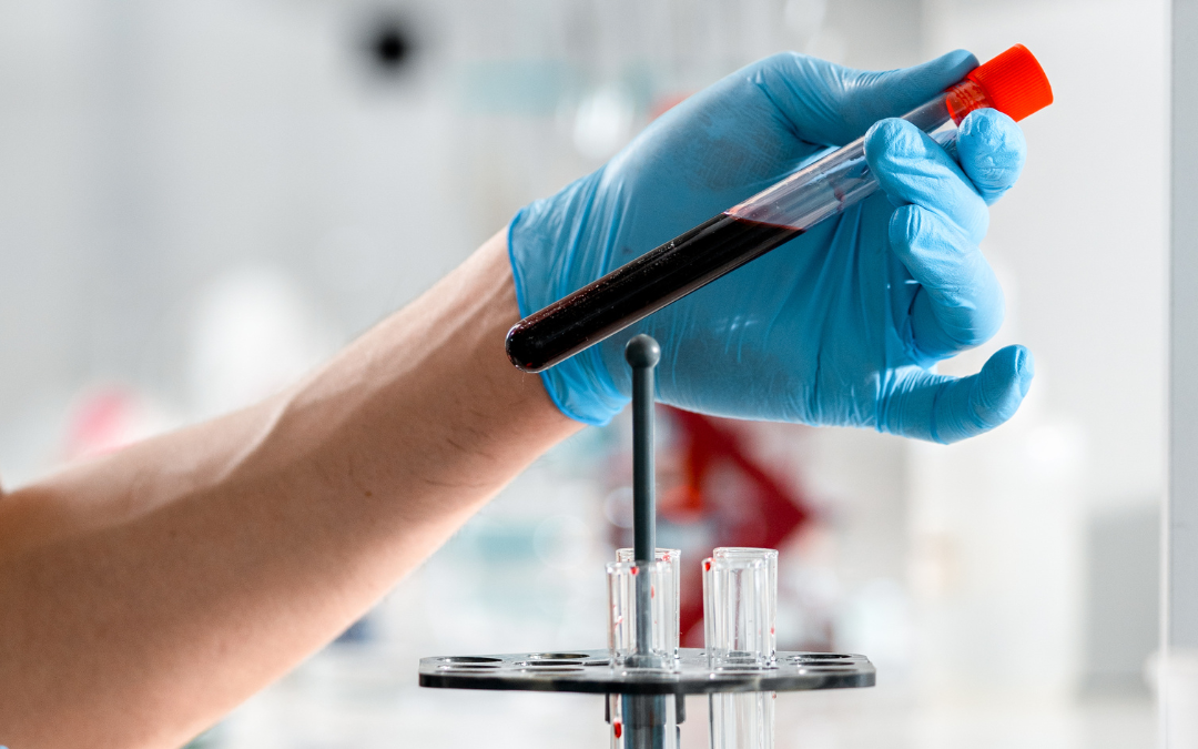 Urgent Care STD Testing: What Patients Should Know